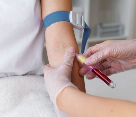 jims hospital hbc image